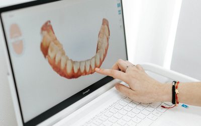 Ortodoncia en Almoradí: tratamientos para alinear tu sonrisa