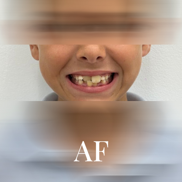 La doctora Ángela Ferrández sosteniendo un molde de dentadura